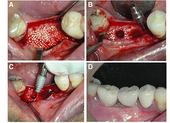 case_3_2