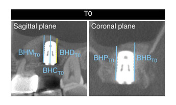 lateral-window-xray-1