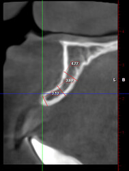 coronal-section