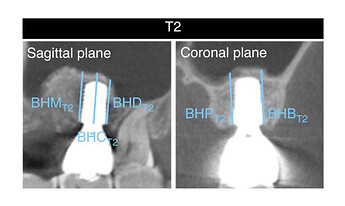lateral-window-xray-3