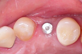 dermis-6