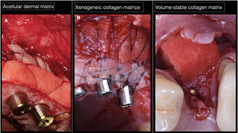 soft_tissue_1_other_grafts