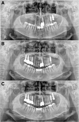 sinus_failure_2