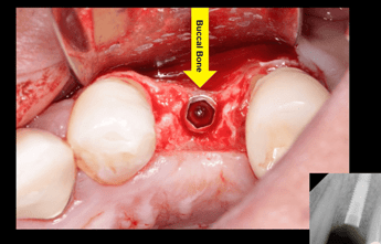 dermis-membrane-4