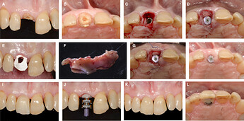 case-1