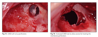 increase in size of window