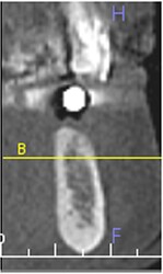 cbct3