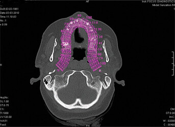 cbct-axial view