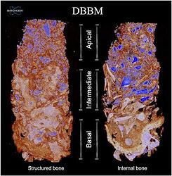 3D Micro‐CT images DBBM
