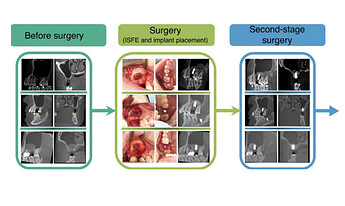 lateral-window-schematic diagram of the retrospective study-1