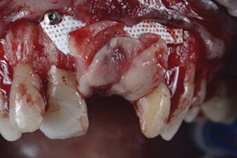 membrane fixation