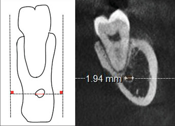 cbct-case2-3