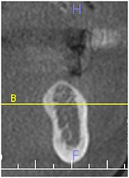 cbct2