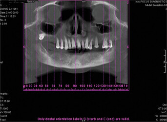 cbct-Panorama