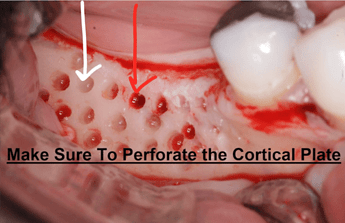 cortical-perf-2