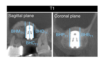 lateral-window-xray-2