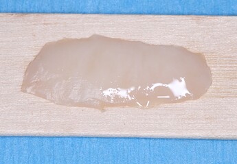 gingival_graft_2