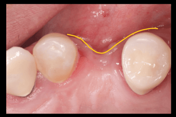 dermis-membrane-2