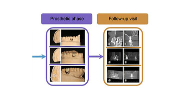 lateral-window-schematic diagram of the retrospective study-2