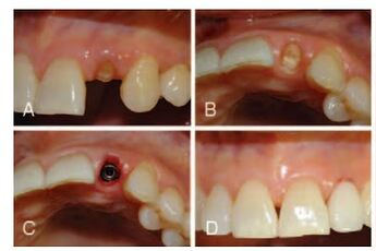 preoperative situation