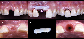 soft_tissue_1_ctg