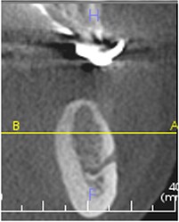 cbct1