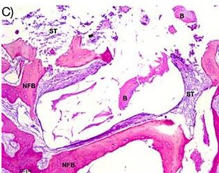middle third of histological sections of groups DBBM