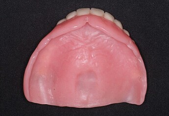denture guide for implant placement