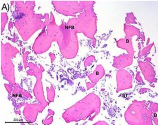 Histological section of the middle‐apical third of the DBBM group