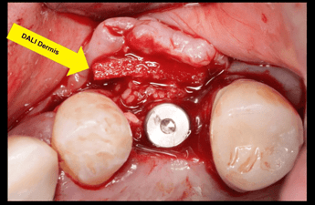 dermis-membrane