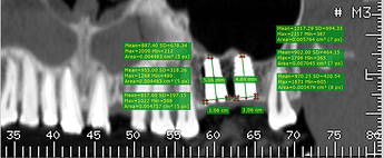 Showing post-operative bone density analysis