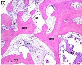 middle third of histological sections of DBBM + H‐PRF,