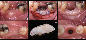 soft_tissue_1_fgg