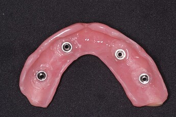 copings  picked up in the denture
