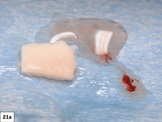 osteogen strip hydrated