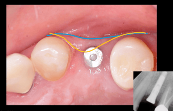 dermis-membrane-5