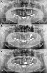 sinus_failure_1