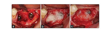 ddm-case-1
